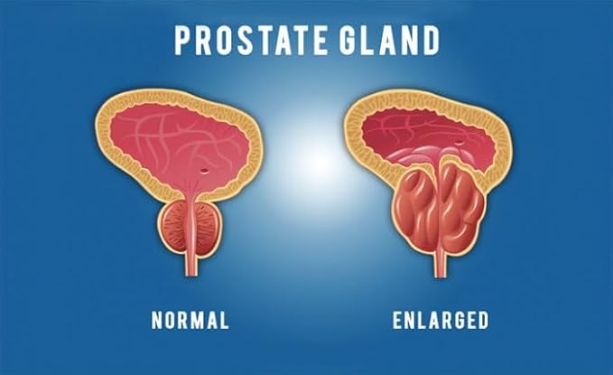 Pulean Formula - Natural Enlarged Prostate Support, Winner of 5 Awards. 240 Tablets