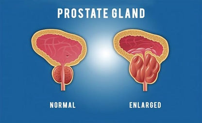 Pulean Formula - Natural Enlarged Prostate Support, Winner of 5 Awards. 240 Tablets