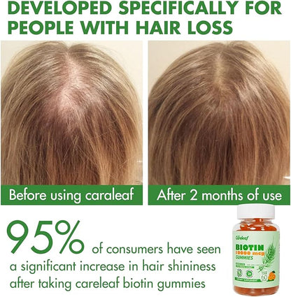 Sugar Free Biotin Gummy Hair, Nails & Skins Gummies-2500mcg Enhanced Hair, Skin & Nails Supplement Orange Flavor 60 Cts/Bottle
