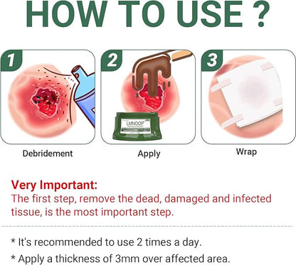 Perianal Repair Ointment: Treatments for Anal Fistula, Anal Fissure, Perianal Abscess, Rapid Relief from Pain, Burning, Itching, Swelling, Bleeding, and Discomfort by Jock Itch or Hemorrhoids