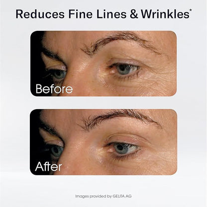 Sparkle Wellness Skin Boost Collagen Capsules (180 Pills) | 30 Days of 2500mg VERISOL Collagen Peptides & Vitamin C | Improves Skin Elasticity & Appearance of Fine Lines | Strengthens Hair & Nails