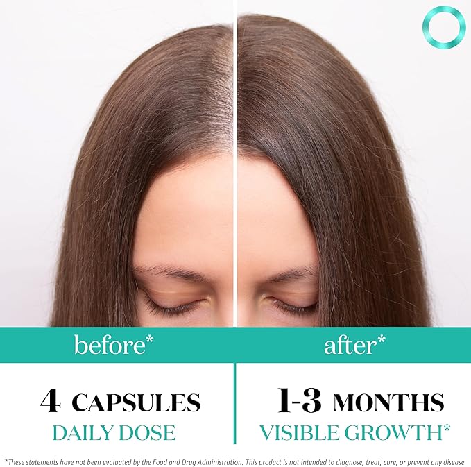 Women's Balance Hair Growth Supplements, Ages 45 and Up, Customer Proven for Visibly Thicker Hair and Scalp Coverage, Soy-Free, Made with 26 Ingredients Including Beta Carotenes - 2 Month Supply