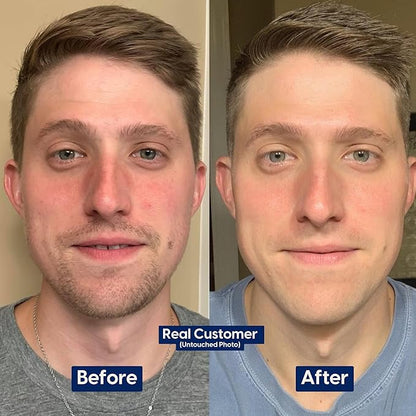 Strive Mens Face Moisturizer, Dark Circle Brightening, Anti Aging Mens Face Lotion with 4% Niacinamide+, Hyaluronic Acid & Ceramides, Hydrating Fragrance Free Skin Care Face Cream - 1.7 fl oz.