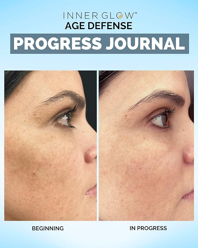 Age Defense Vitamins - Dermatologist and Plastic Surgeon Developed to Fight photoaging and Melasma, Polypodium Leucotomos Antioxidant Formula – Vegan, Gluten-Free – 60 Capsules