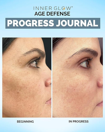 Age Defense Vitamins - Dermatologist and Plastic Surgeon Developed to Fight photoaging and Melasma, Polypodium Leucotomos Antioxidant Formula – Vegan, Gluten-Free – 60 Capsules
